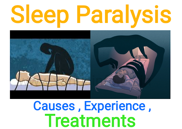 What is Sleep paralysis , cause of sleep paralysis