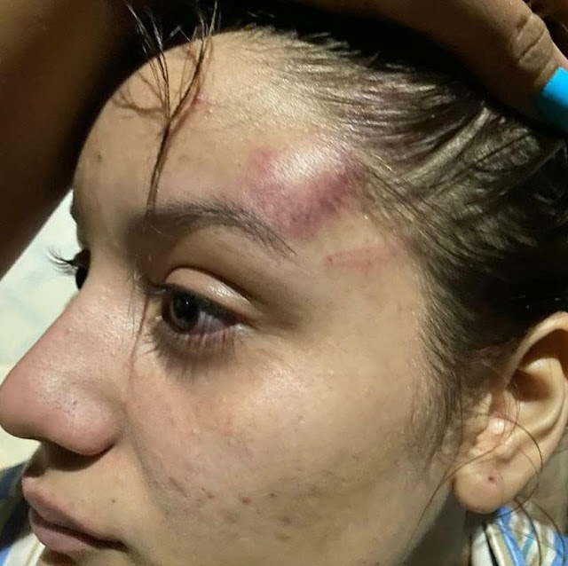 Jovem afirma ter sido abusada pelo padrasto desde criança faz desabafo e clama por justiça