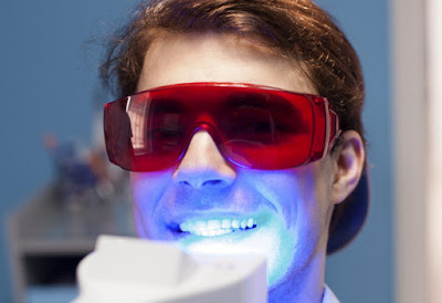 Tẩy trắng răng bằng phương pháp Laser Whitening