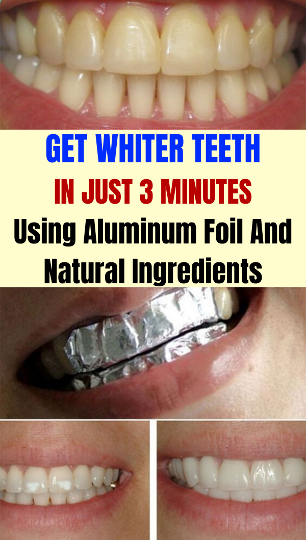 Get Whiter Teeth In Just 3 Minutes Using Aluminum Foil And Natural