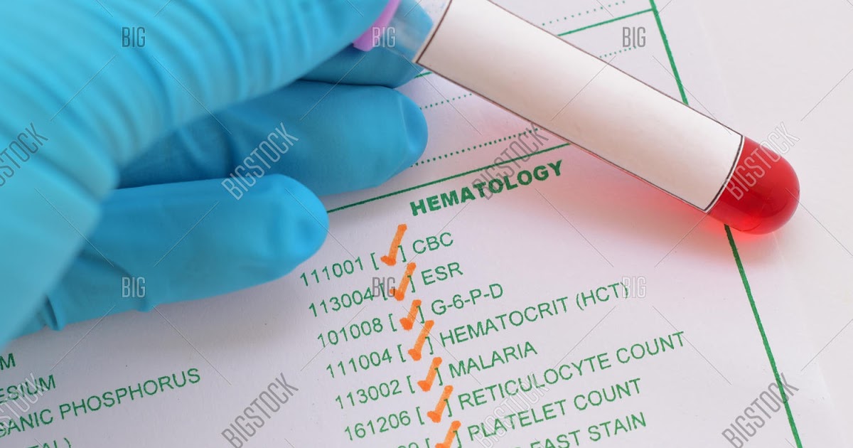Hematology Tests and Procedure Imad Analis Blog