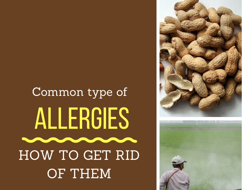 Common type of Allergies and How to get rid of them truehealthytipz