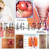 Gambar AmbeJoss Obat dan Jenis Wasir thumbnail