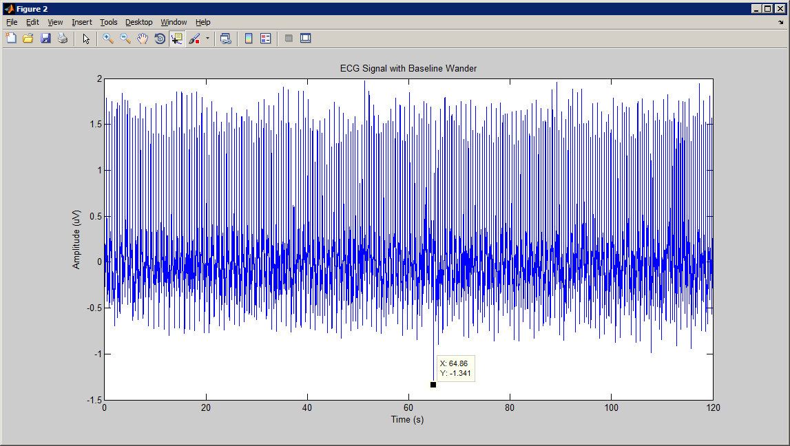 Biomedical Signal and Image Processing projects using Matlab and