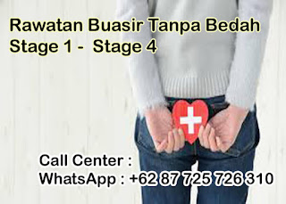 ubat tradisional cina untuk buasir paling dipercayai