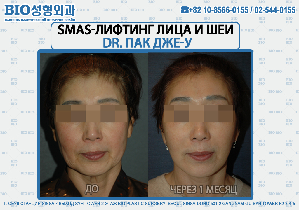 биос пластическая хирургия