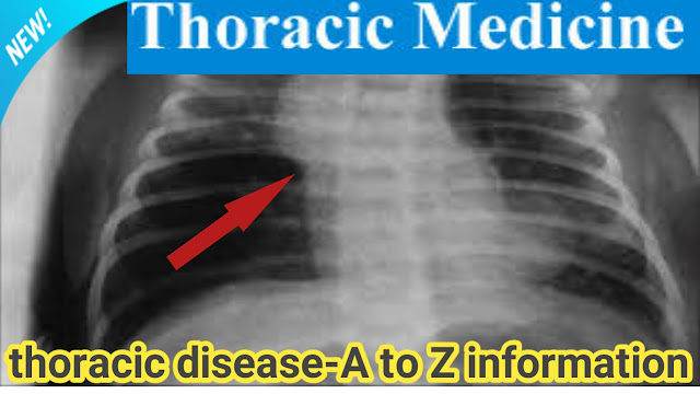 What does a thoracic medicine specialist do?,What is thoracic disease?,Why would you be referred to a respiratory clinic?,Thoracic medicine Wikipedia,Thoracic medicine appointment, Thoracic medicine first appointment,What is thoracic medicine used for