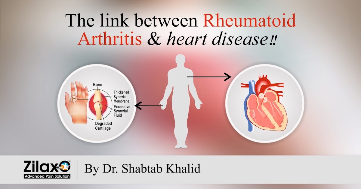 Zilaxo Advanced Pain Solution The Link Between Rheumatoid Arthritis