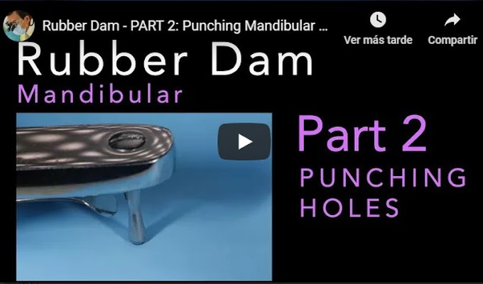 RUBBER DAM - PART 2: Punching Mandibular Holes - Richard Stevenson