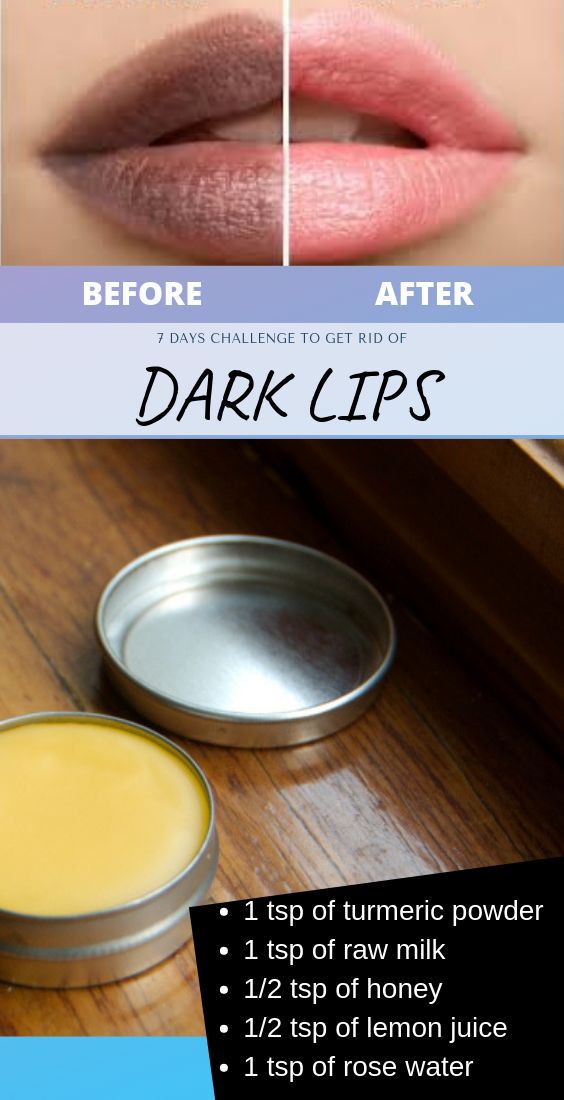 GET Light Color Lips Turn Black Lips To Natural Pink wellness magazine