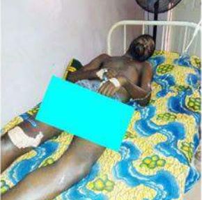 Photos: Unknown gunmen shoots Corps member in Benue state, kill his younger brother