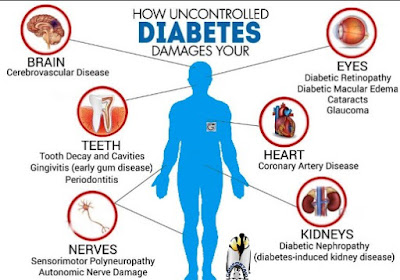 Complications Associated with Juvenile Diabetes