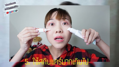 5 สิ่งที่เข้าใจผิดเกี่ยวกับสิว ไม่ว่าจะเป็นสิวอุดตัน สิวผด สิวอักเสบ อยากสิวหายต้องดู | WaanSannie