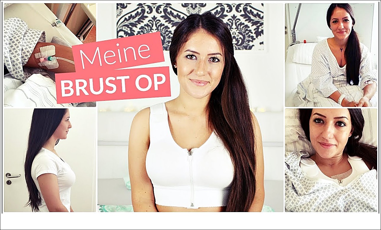 Meine BRUST OP   BILDER -Brustvergrößerung Erfahrungen -Schönheits OP Vorher Nachher - TEIL 1/2 ...