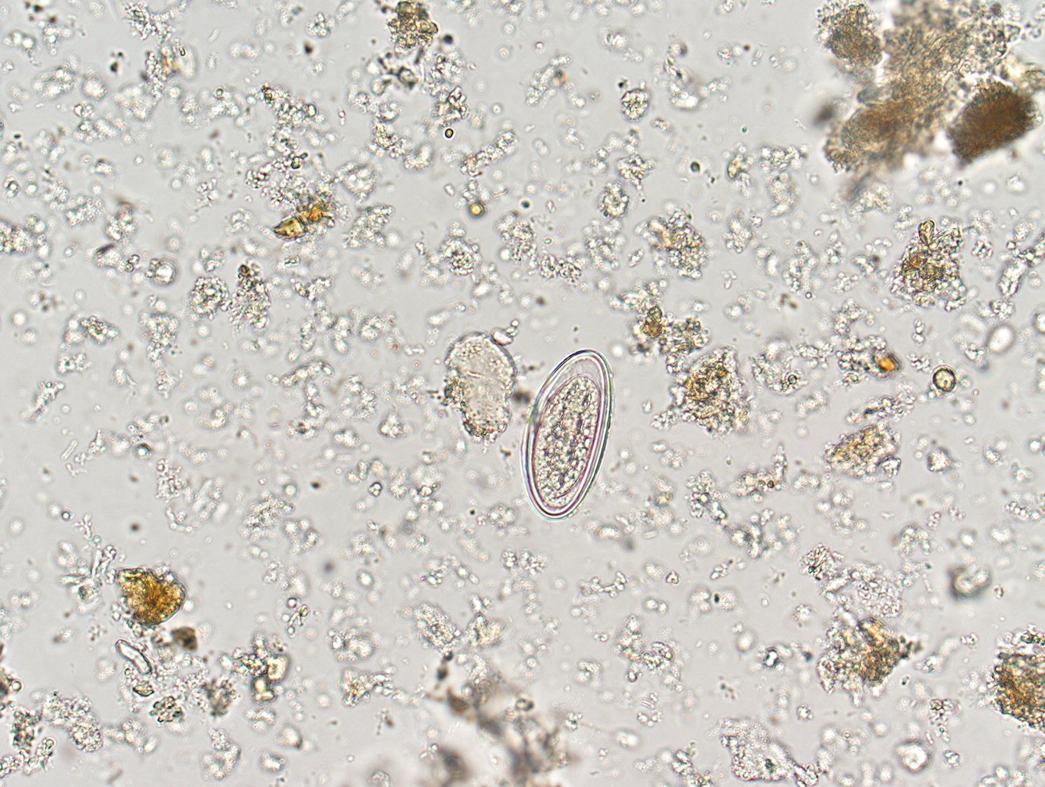 Creepy Dreadful Wonderful Parasites: Case of the Week 434
Pinworm Eggs In Poop