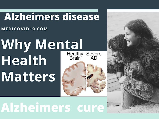 9 Best natural homeremedies for Alzheimers cure