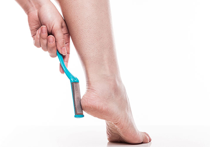 AdventureLisa Removing calluses is good foot care practice