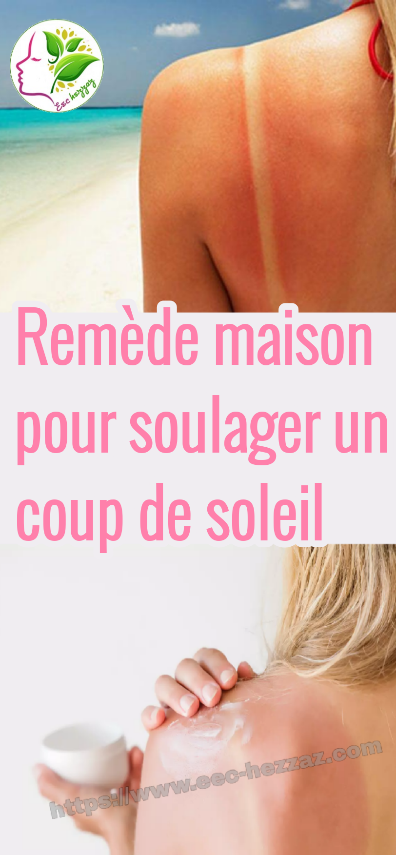 Remède maison pour soulager un coup de soleil