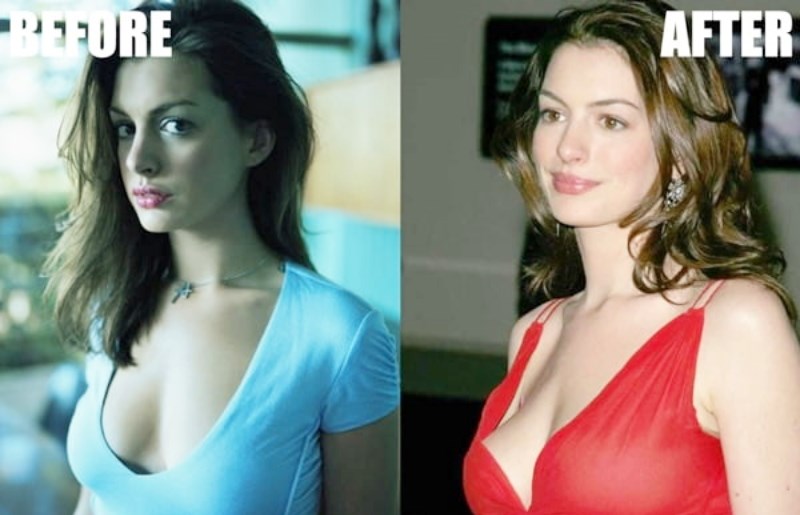 Món ăn "ngang ngược" được làm từ "thứ rau của quỷ" khiến kẻ khóc người cười 4 My nhan co anne hathaway boob job 2 1626663960 271 width800height515