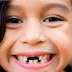 Quy trình nhổ răng trẻ em