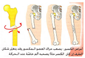 الحوادث التي تصيب العظام والعضلات والمفاصل