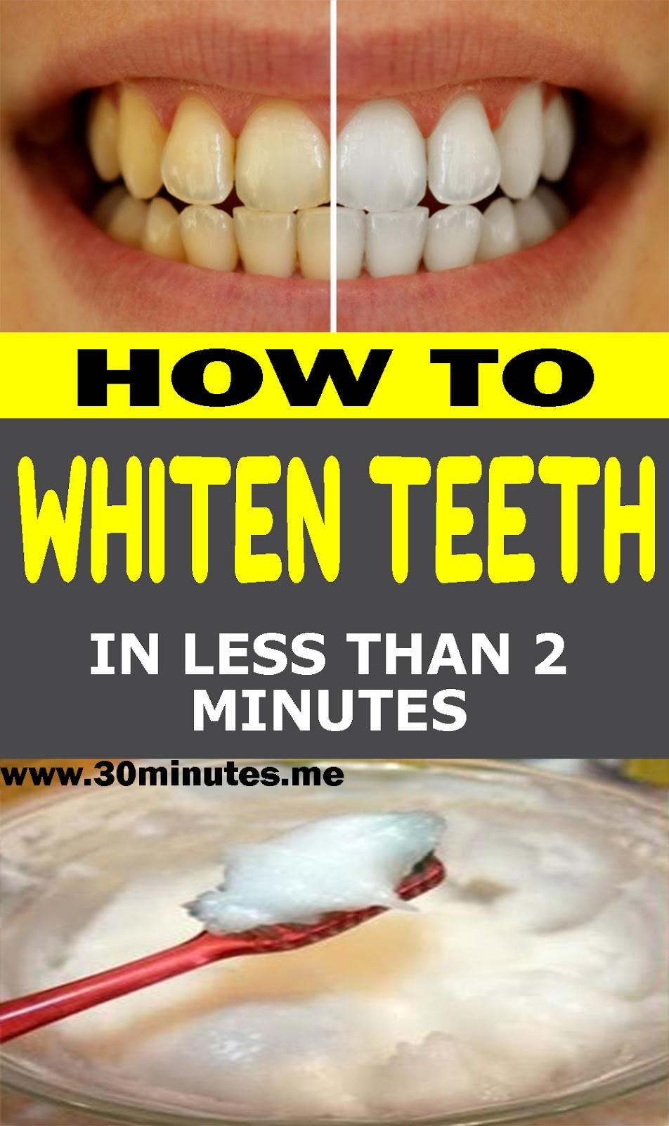 GUARANTEED! WHITEN YOUR YELLOW TEETH IN LESS THAN 2 MINUTES!