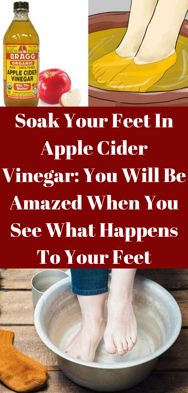 Soak Your Feet In Apple Cider Vinegar You Will Be Amazed When You See
