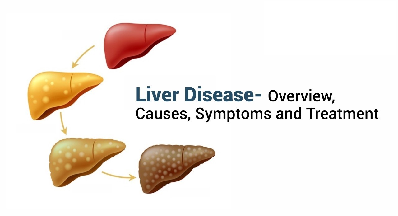 Healthcare Liver Disease