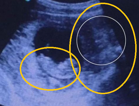 demon watching baby mother's womb
