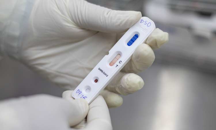 Bahia registra 4.579 novos casos de Covid-19 e 91 óbitos