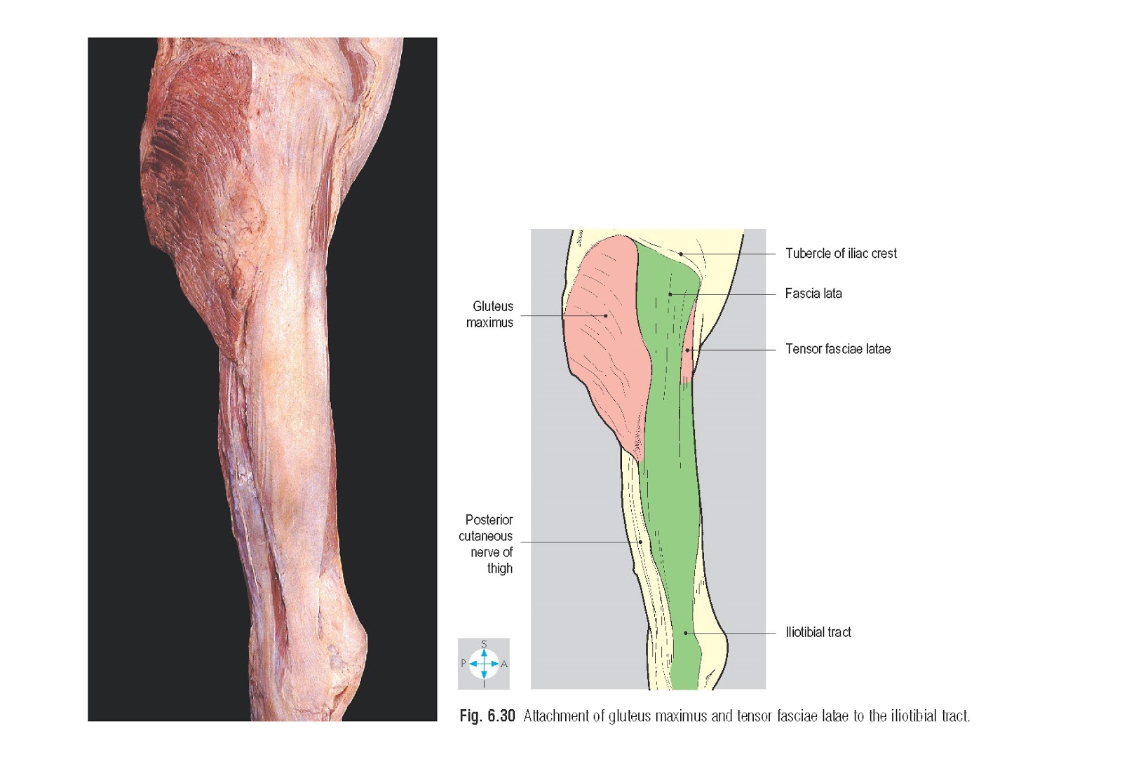 Gluteal Compartment Anatomy pediagenosis