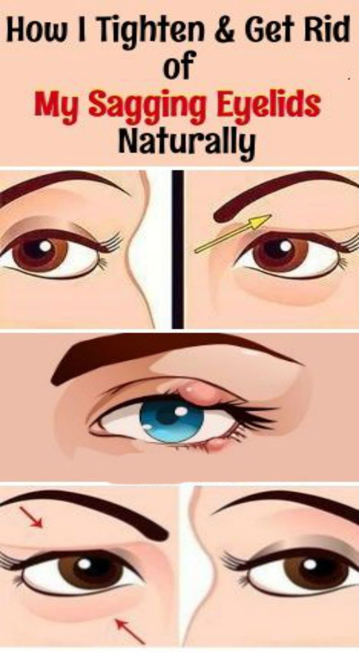 How To Lift Up Sagging Eyelids wellness magazine