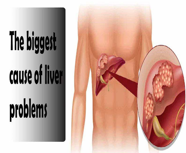 The biggest cause of liver problems