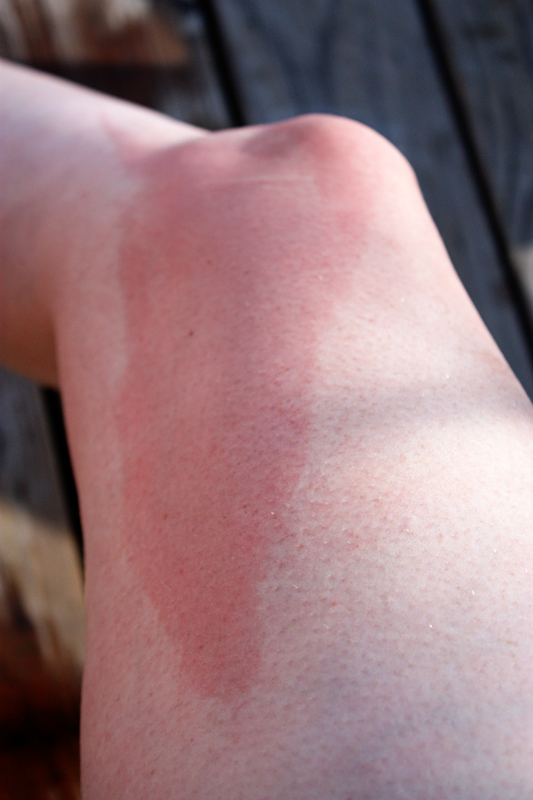 Seriously... Thoughts? Burn Baby Burn