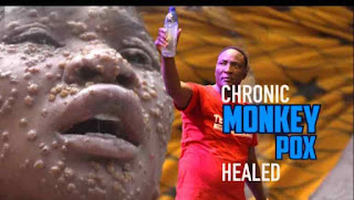 Woman Miraculously Healed Of Monkey Pox at Prophet Fufeyin’s Church [Watch Video]