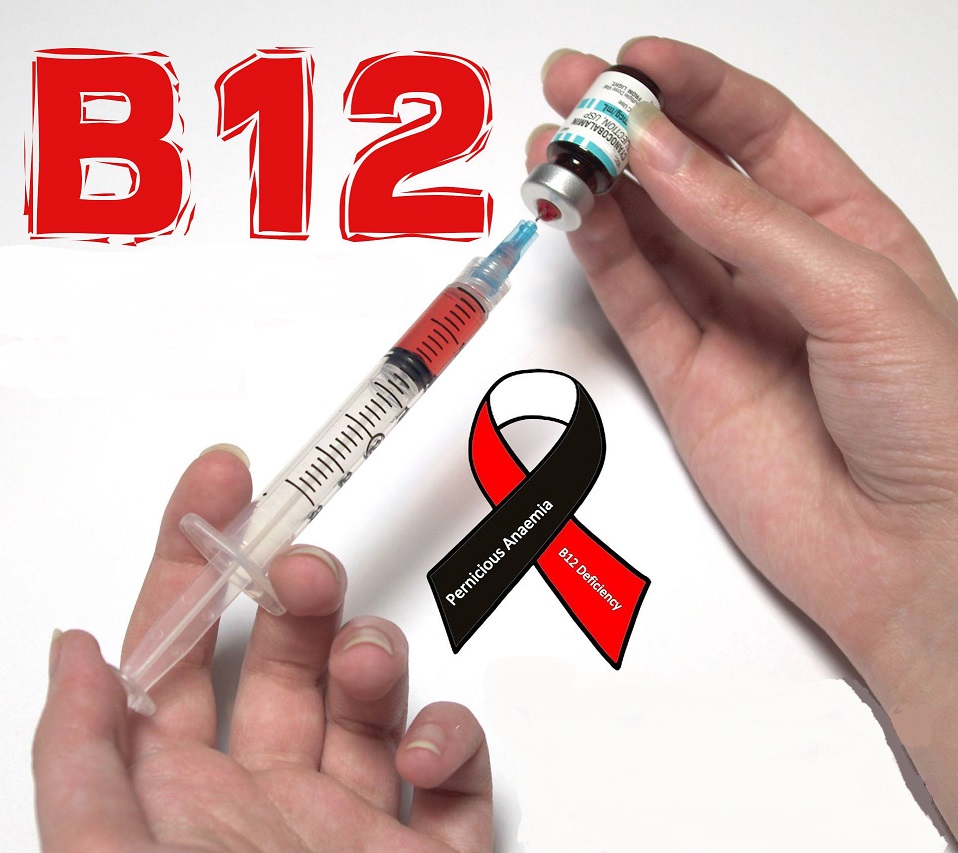 UNDIAGNOSED VITAMIN B12 DEFICIENCY? CAN YOU OVERDOSE VITAMIN B12?