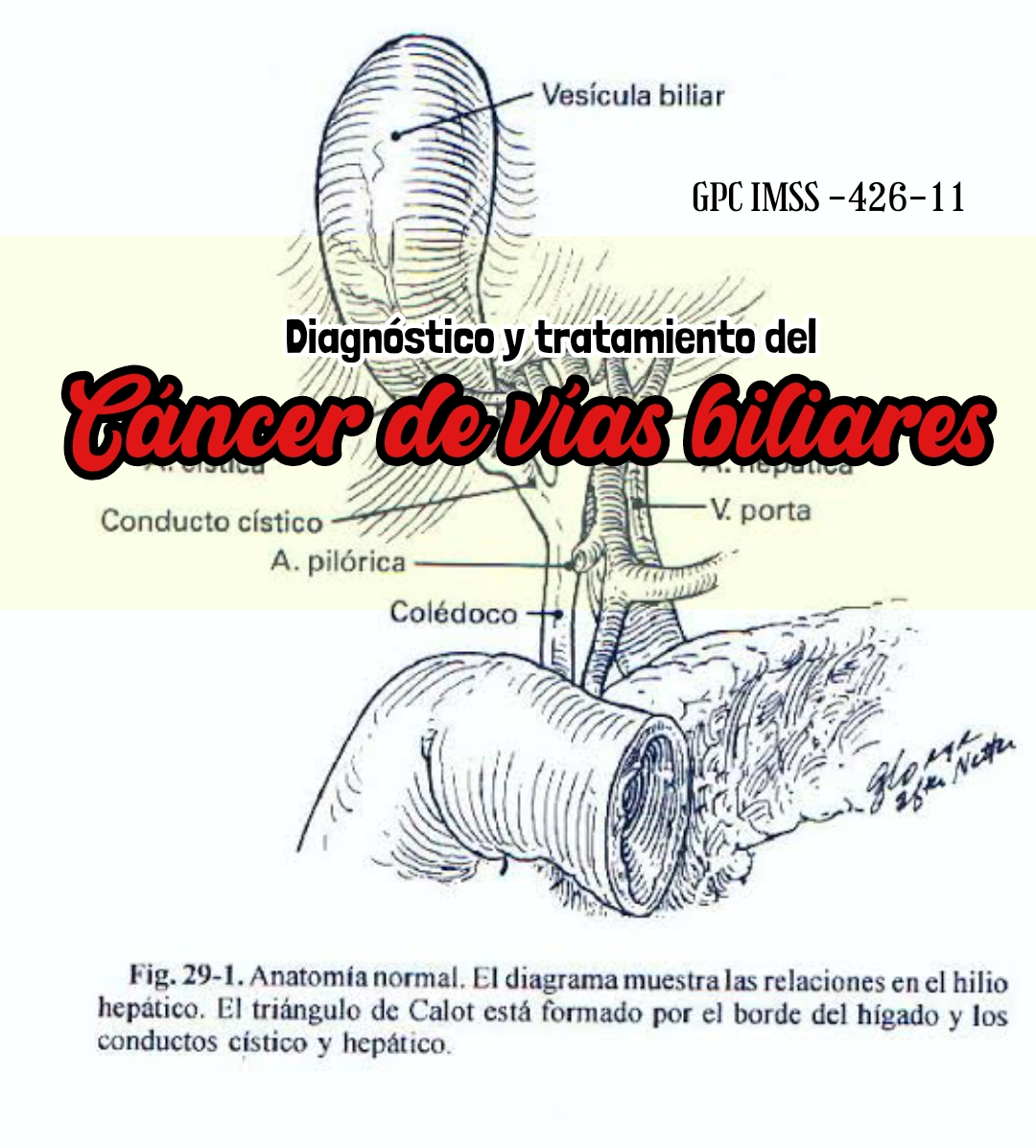 CANCER DE VIAS BILIARES Dr GALVAN