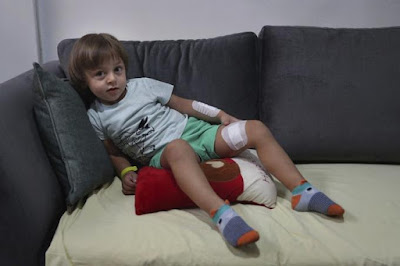 Los niños en Beirut sufren trauma tras la potente explosión Los niños en Beirut sufren trauma tras la potente explosión