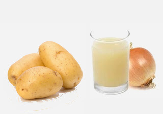 Potato Juice and Onion Juice Hair Pack