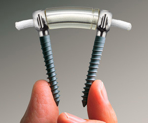 van Rugpijn naar een Fijne rug: Dynesys