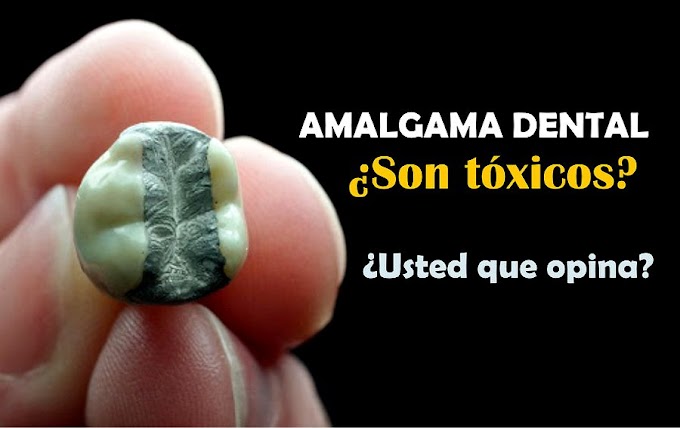 AMALGAMA DENTAL: ¿Son tóxicos estos empastes? - Entrevista al Dr. Francisco Enrile