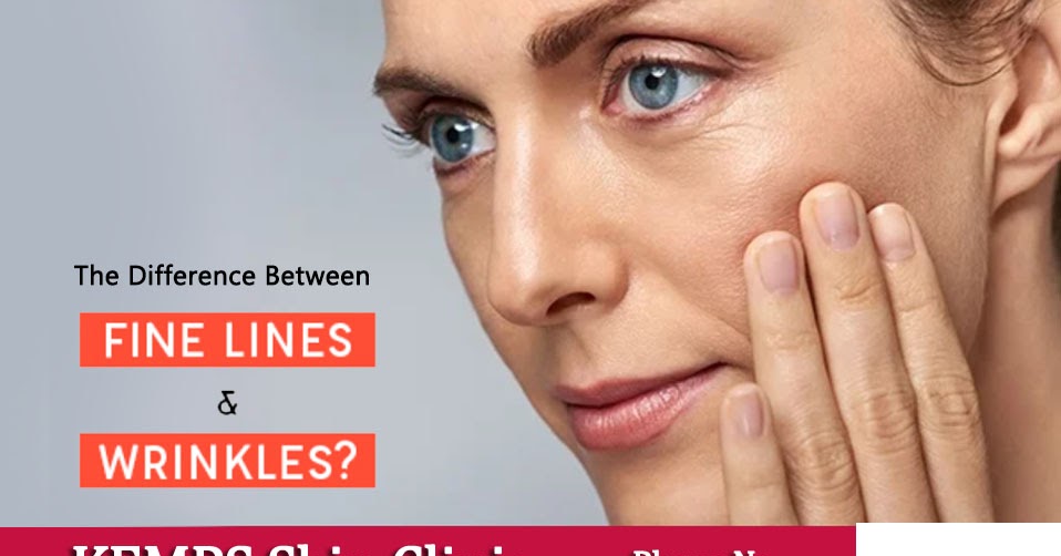 What is the difference between wrinkles and fine line? KEMPS Skin Clinic