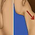 How To Get Rid of Lump On Your Neck, Back or Behind Your Ear Naturally By These 7 Best Home Remedies