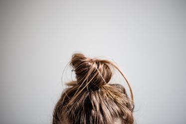 Dandruff Dandruff, dandruff treatment