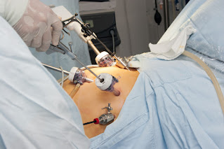 cirurgias bariátricas no SUS