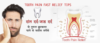 दाँत दर्द या जाड़ दर्द से तुरन्त आराम व छुटकारा Toothache Relief in Hindi