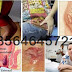 Harga Obat Ambe-JOSS Untuk Wasir thumbnail