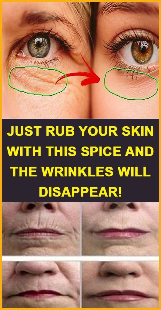Just rub your skin with this spice and the wrinkles will disappear!