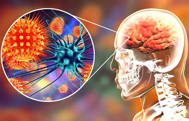 Functional Neurology: Understanding Autoimmune Brain Disease | El Paso, TX Chiropractor