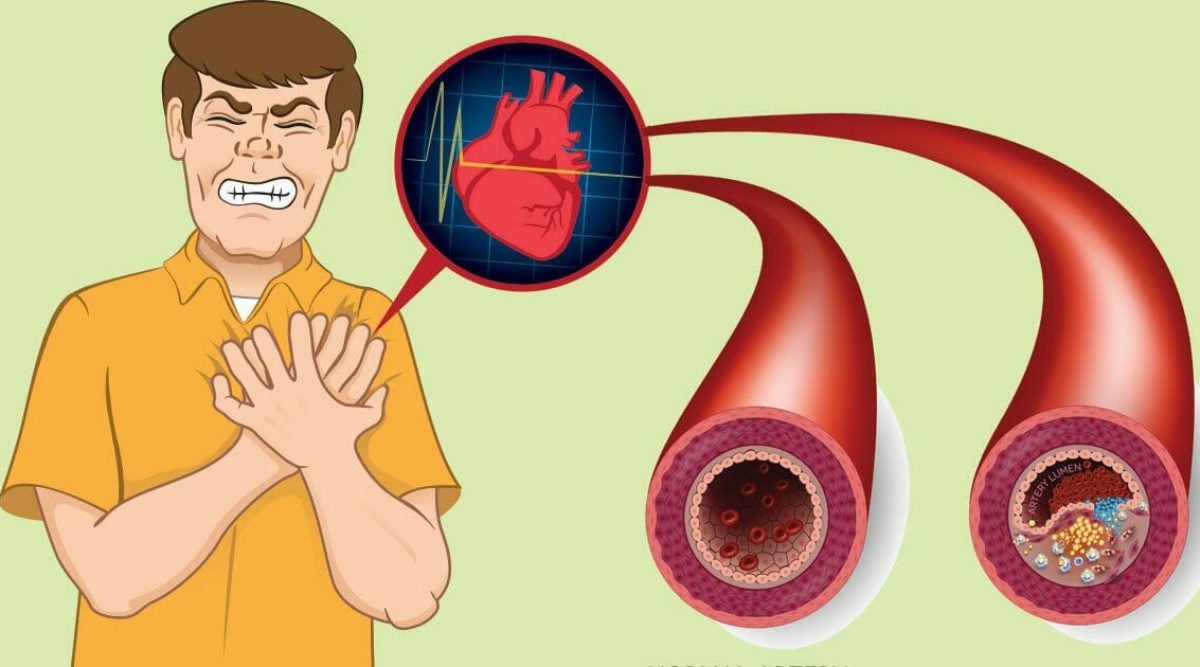 9 Foods That Clean Your Arteries And Prevent Heart Attacks